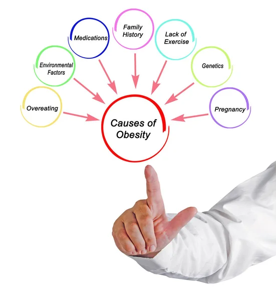 Oorzaken en gevolgen van obesitas — Stockfoto